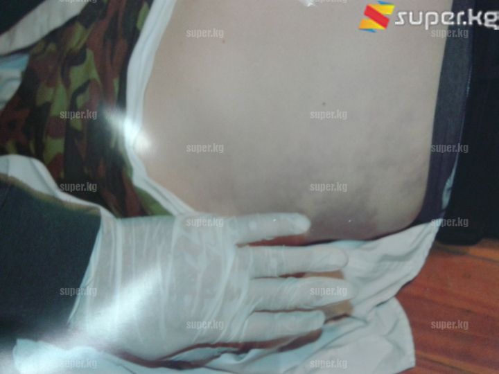 "Инимдин бөйрөк тарабы көк-ала экен, андай тактар бутунда,колунда да бар. Анан кантип мен ал жүрөгү кармап өлгөнүнө ишенем" деп ыйлады маркумдун тууганы.  