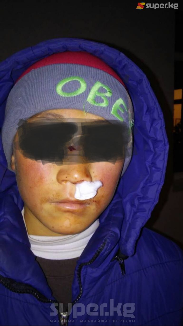 Жабырланган өспүрүм.