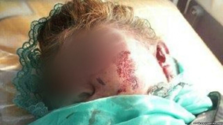 Сүрөттө сабалган 52 жаштагы Тургуной Олтинова.