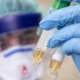 Өткөн суткада коронавирус илдетинен каза болгондор жок