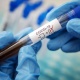 Бир сутка ичинде COVID-19 оорусунан пневмонияны эске алганда 1289 адам сакайып чыкты