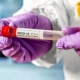 Бир суткада 75 адамдан коронавирус аныкталса, 102 бейтап илдетти жеңип чыкты